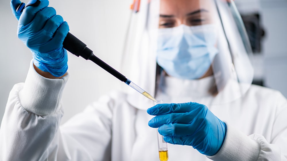 Useful tool for the Remove of Aggregates in Antibody Purification
